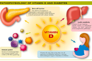 Mini-review. Vitamin D for the prevention of type 2 diabetes: Evidence and implications