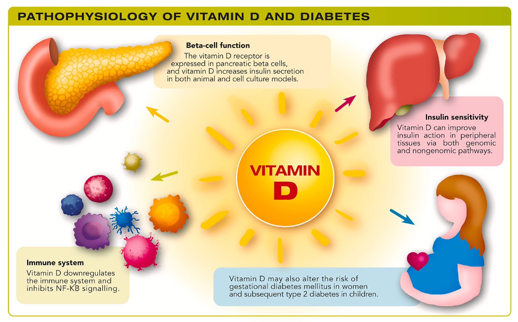 Mini-review. Vitamin D for the prevention of type 2 diabetes: Evidence and implications Mini-review. Vitamin D for the prevention of type 2 diabetes: Evidence and implications